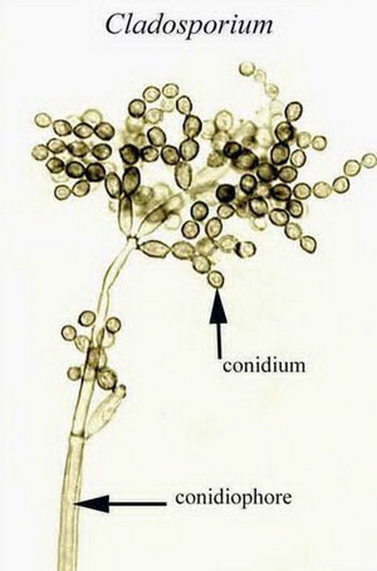 Cladosporium sphaerospermum 2
