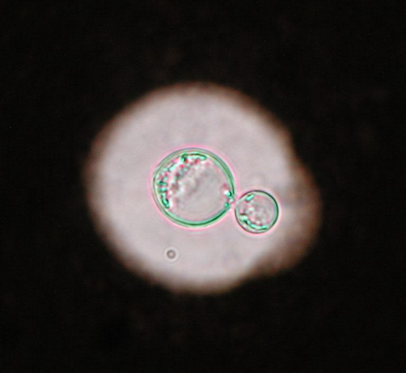 Cryptococcus neoformans 1