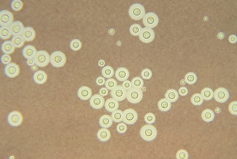 Cryptococcus neoformans 2